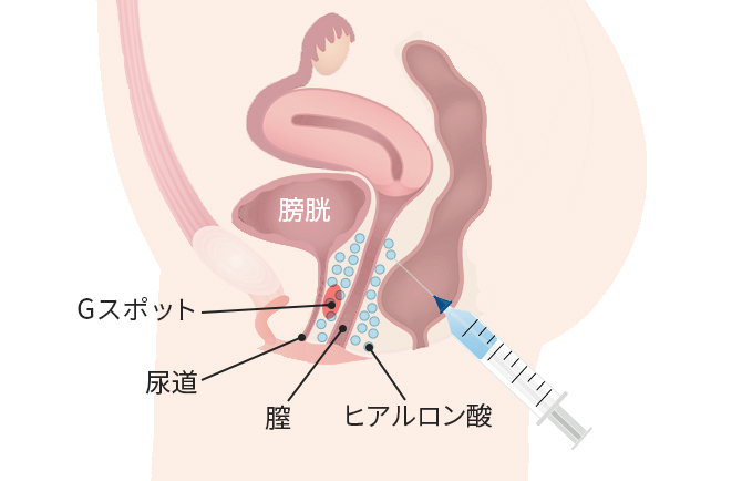 女性が感じる仕組みとは？オーガズムとスキーン腺の関係について解説 | コラム一覧｜