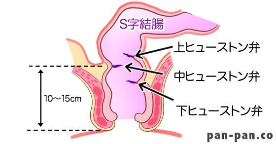 90mmアナルプラグ入れるまで拡張したよ。S字結腸も超えてオーガズムした。