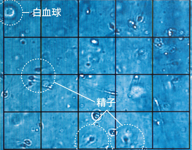 妊活夫婦【タテヨミ】 40巻｜まんが王国