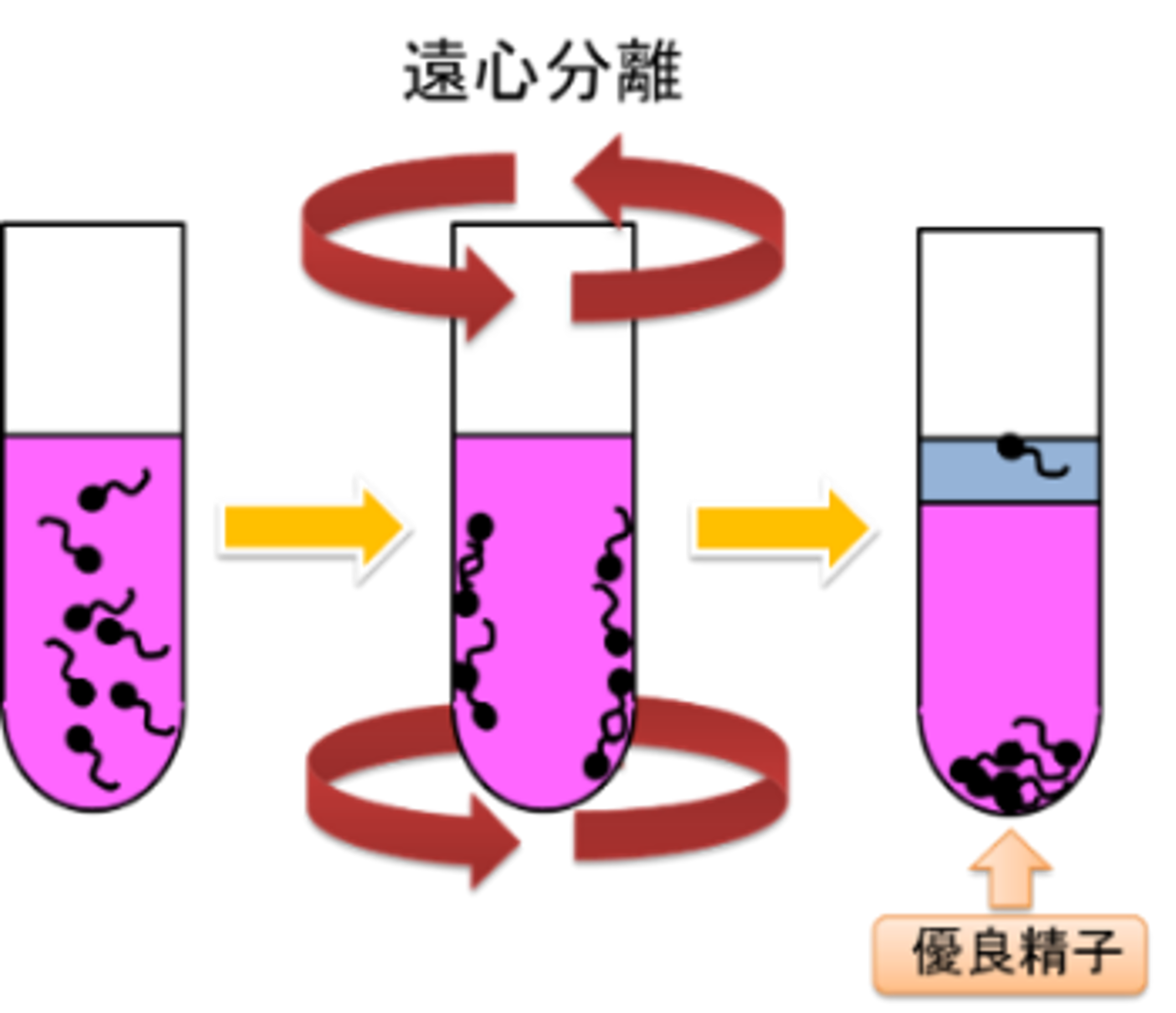 精子の数が少ない｜泌尿器と男性不妊のクリニック｜埼玉県さいたま市大宮区の泌尿器科