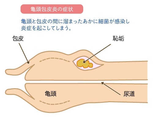 50%OFF】伊ヶ崎綾香は亀頭攻めがしたい! [伊ヶ崎綾香の庭] |