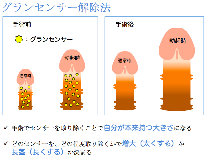 亀頭増大術・ペニス増大について｜MSクリニック