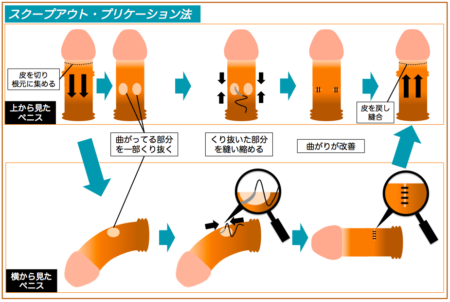 勃起角度を上反りにしたい！下反りちんこでは女性は物足りない？