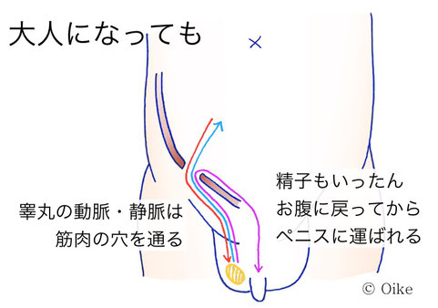 本当はこわい 鼠径ヘルニア手術』について｜診療科からのお知らせ｜外科｜独立行政法人国立病院機構 京都医療センター