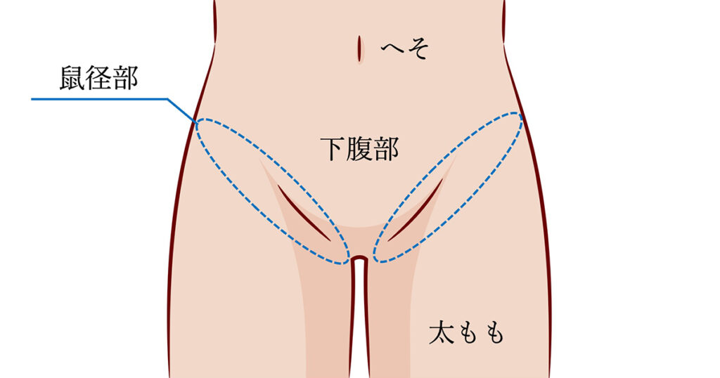 女子の鼠径部がえちえちなエロ画像 - 性癖エロ画像 センギリ