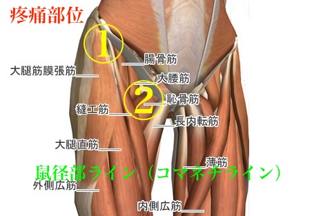 越谷市の鼠径ヘルニア（脱腸）の患者さんに当院が選ばれる理由とは？