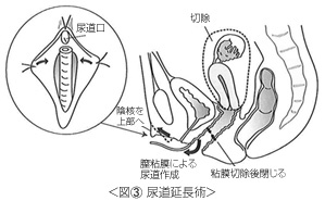 性転換手術 | 美容外科ヤスミクリニック