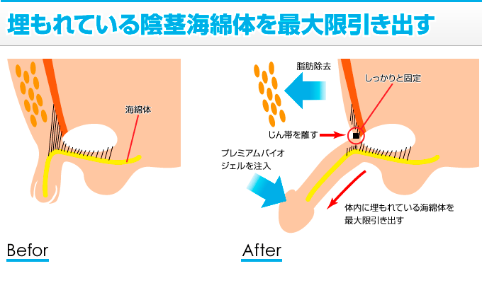 ペ○スの長さ・角度・硬さの正確な身体測定法【ペ○ス世界ランキング】 - YouTube