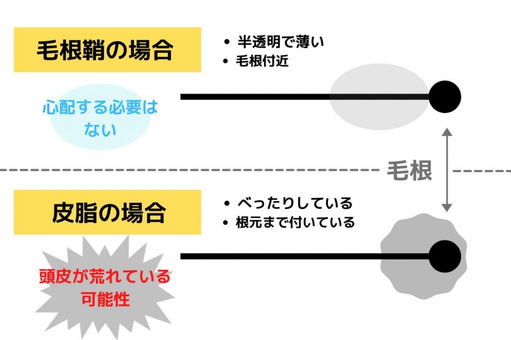 抜け毛を毛根から解析｜根本に白い塊のついた毛と黒い毛は危険信号？｜「ヘアメディカル」by Dクリニック