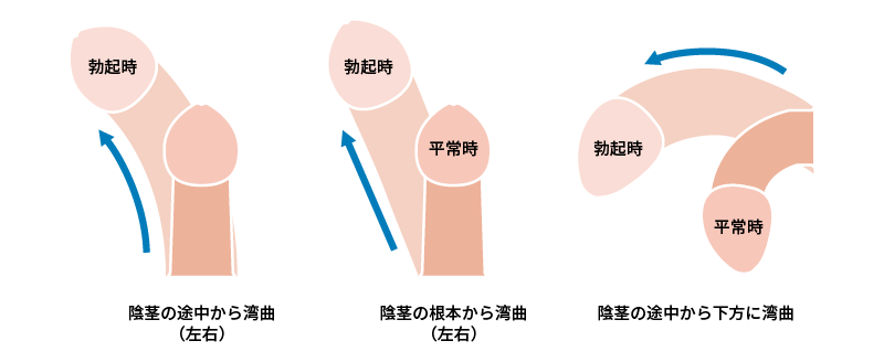 日本人のペニス、平均的サイズは13cm。女性からすると長さは関係ない｜あんしん通販コラム