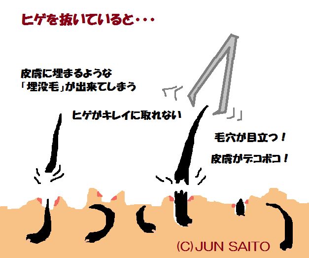 髭を抜くと起きる５つの危険！肌トラブルになったときの対処法も解説 | まるわかりメンズ脱毛