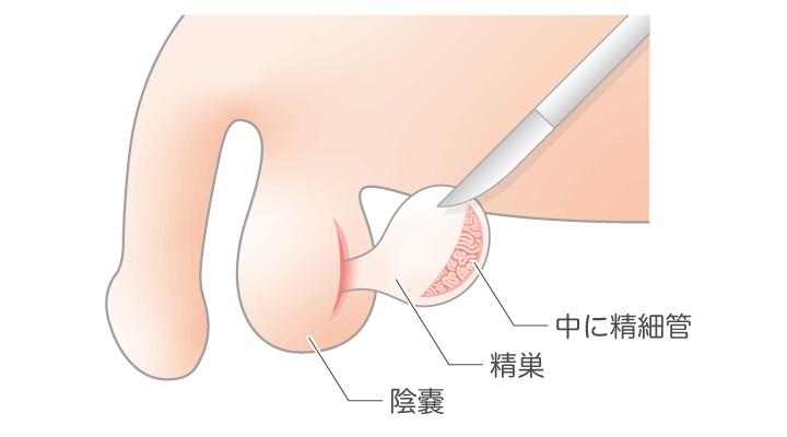 精子のためにできること | 桃クリブログ – 大阪の不妊治療なら【園田桃代ARTクリニック】