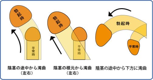 ガチ反り|アダルトグッズや大人のおもちゃ、玩具の通販ショップのNLS