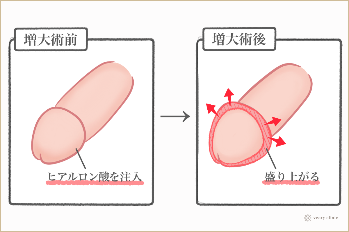 カズ博多クリニック - ☘女性は大きな亀頭を望んでいるのか⁉☘﻿