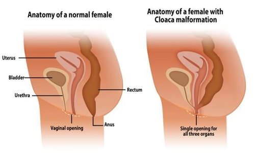 童顔美少女のアナルセックス】妹系女優が未経験だったお尻の穴のエッチを解禁！野外で浣腸スプラッシュし羞恥的興奮！生で挿れられて中出しに悦ぶ！ |  アナルラボ -