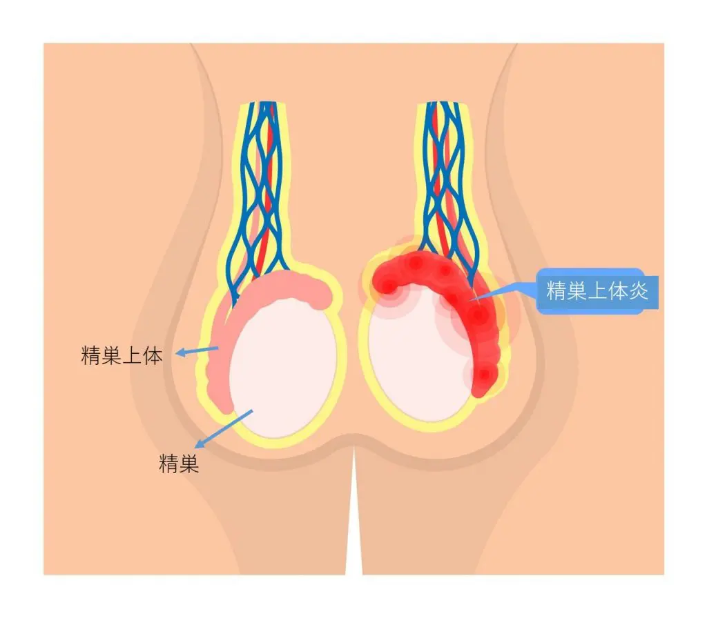 健康診断の前夜にオナニーして大丈夫？毎日しこったら病気に？健康