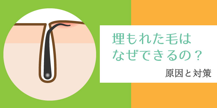 癖になっていたら要注意】ヒゲ（髭）を抜くことで招きうるリスクの代表例と改善方法一覧