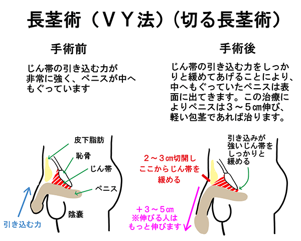 静岡の亀頭増大術のおすすめクリニック｜メンズ版 美容医療の口コミ広場