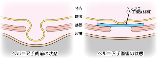 楽天市場】オーガニックコットン ふんどしショーツ [大阪生まれのコットン