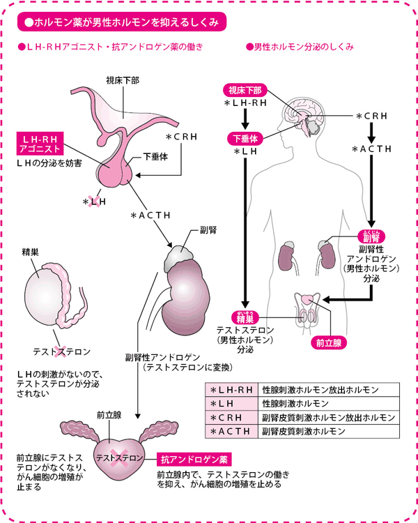 前立腺がんの「ホルモン療法（内分泌療法）」治療の進め方は？治療後の経過は？ – がんプラス