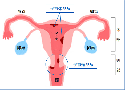 がん治療は卵巣機能にどんな影響があるの？－女性の場合 - がんwith