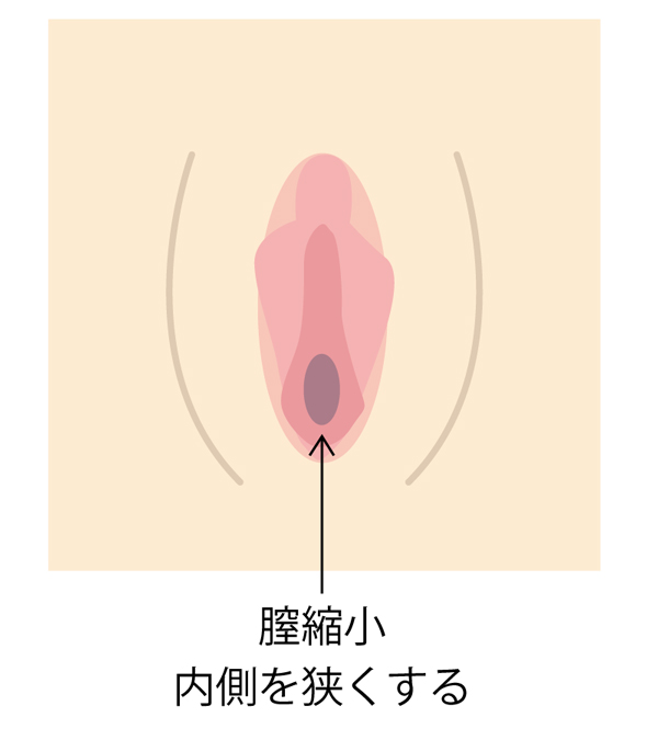 トランスジェンダーの方々の性別適合手術（性転換手術）後の性感染症（STI）検査は? | GME医学検査研究所