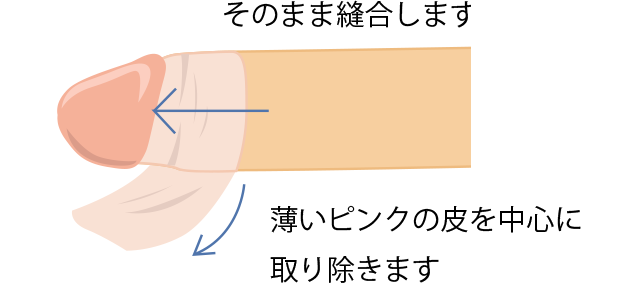 高品質 亀頭ゾリゾリ「連続のどちんこほーる」