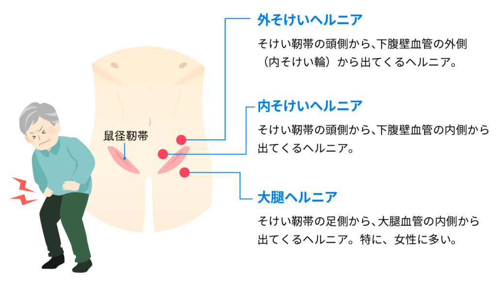 京都】医療脱毛で都度払いが安いクリニックTOP9！ | 脱毛Note