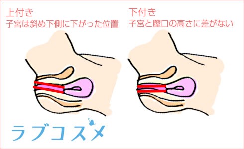 Gショット（Gスポットヒアルロン酸注入） | 美容整形外科のジョウクリニック