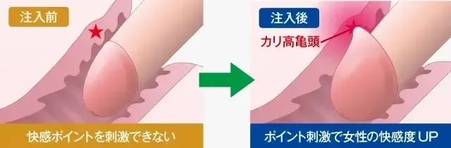 あの『ペニスの形』には意味があるの？ちんこの亀頭があの形の理由【ラブコスメ】