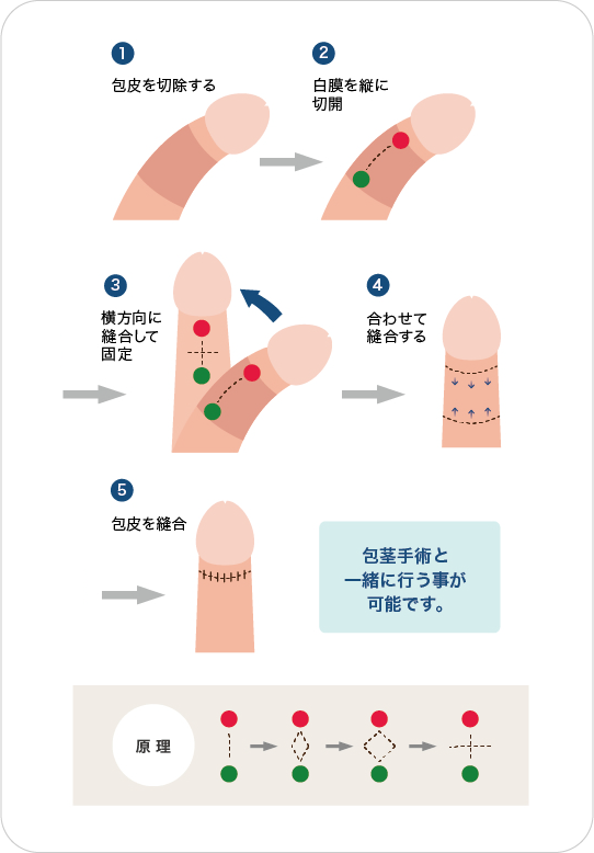 反りチンとは？反り方の違いやおすすめの体位も解説！｜風じゃマガジン