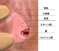 Gスポット注射｜銀座の美容外科・皮膚科ならルーチェクリニック