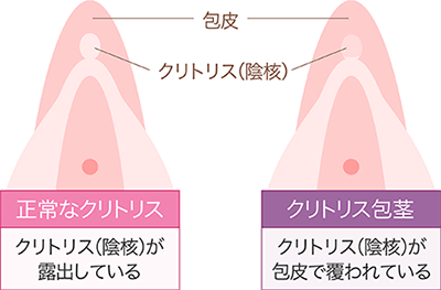 クリトリス刺激でイカせる手マン・触り方５選【図解】 | セクテクサイト