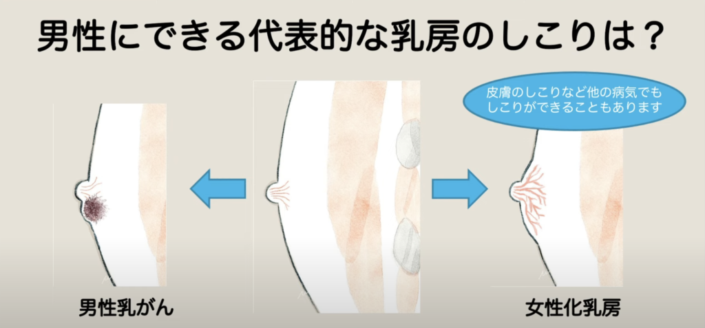 男性必見！女性が嫌がる乳首ポコ(乳首が目立つシャツ)解決方法 | ダメ男成長記録