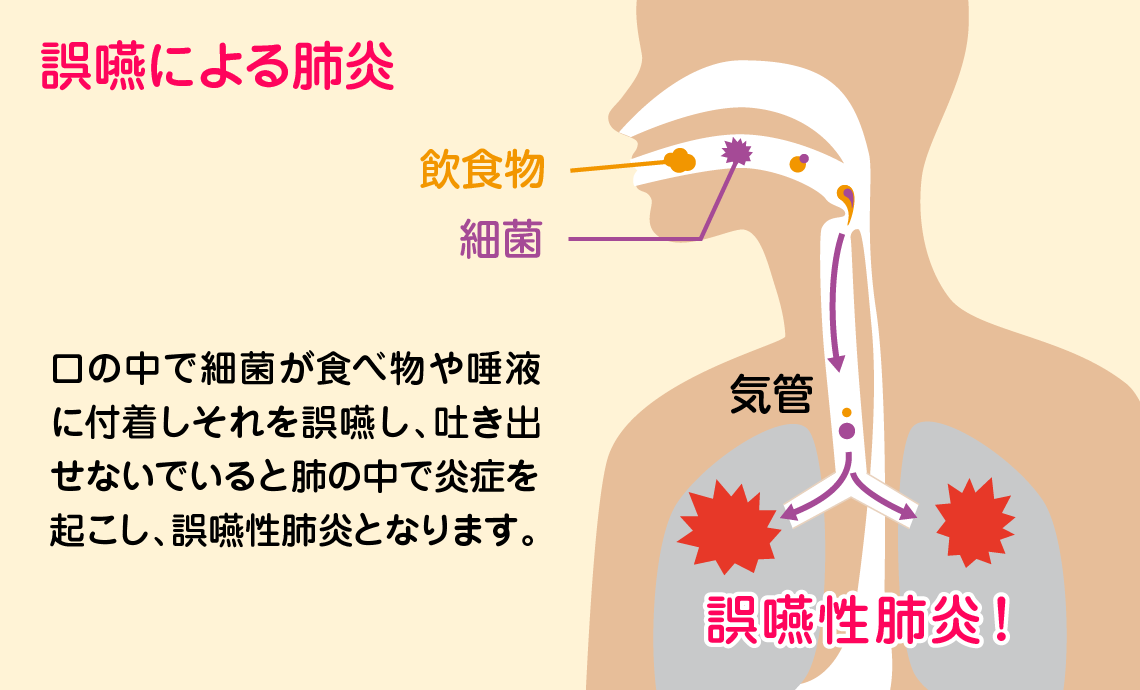 認知症の人への服薬介助の工夫 | 認知症を知る |