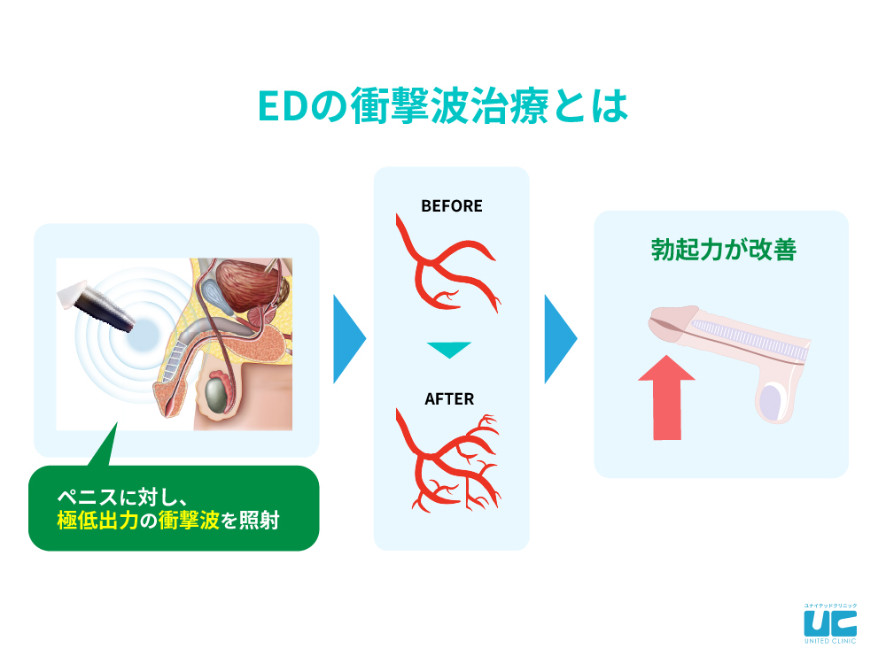 おすすめのぼっき持続サプリは？購入場所に合わせた選び方を覚えよう！│健達ねっと