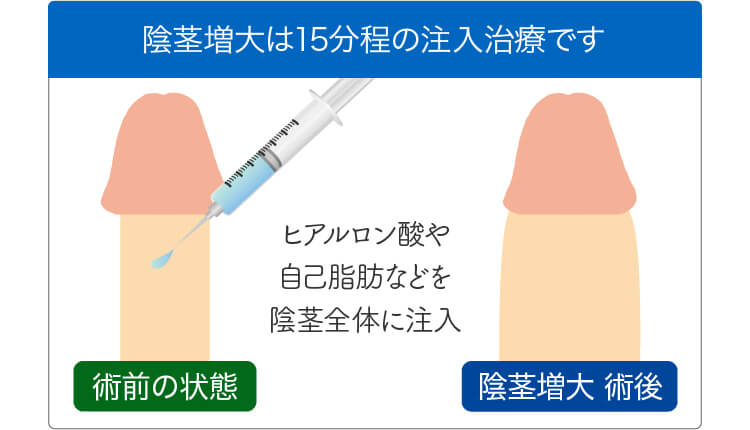 ペニスのサイズ比較