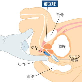 前立腺オナニー(アナニー)の姿勢・体勢について ※画像でわかりやすく解説してみた | 男のオナニーを気持ち良くする方法・やり方まとめ【オナニスタ】