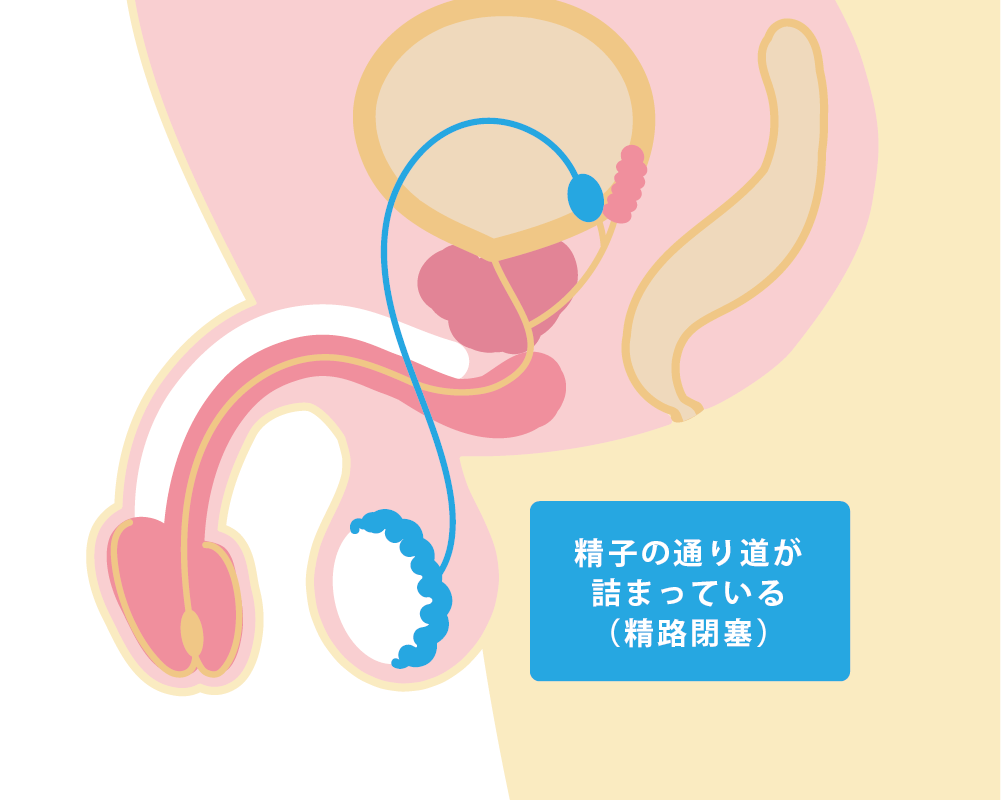 精子非常苦正常吗