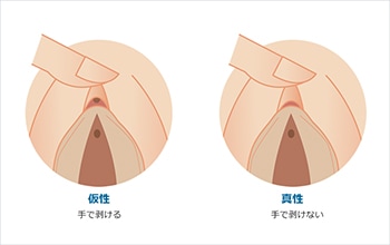 クリトリスの皮の剥き方を画像で解説！自分で剥く・剥いてもらうやり方