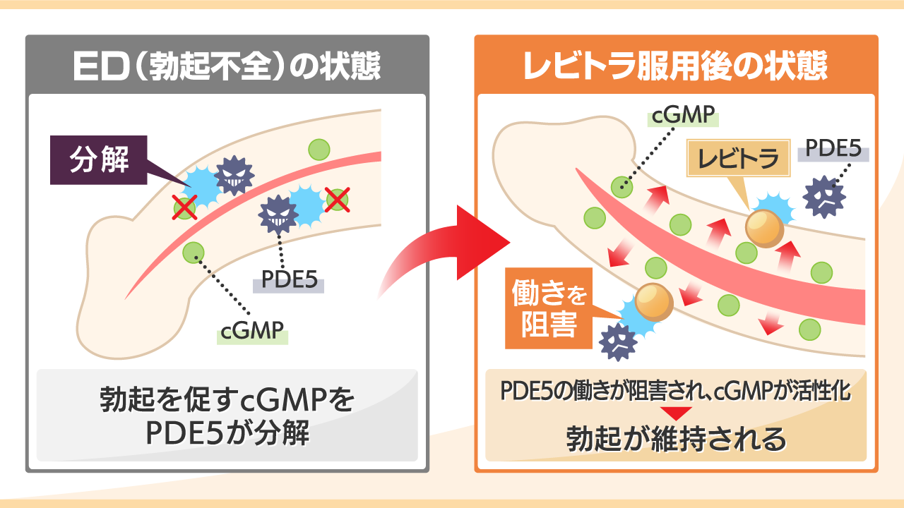 医師監修】レビトラの飲み方とは？正しい服用タイミングや注意点について｜イースト駅前クリニックのED治療