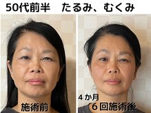 栃木県佐野市エステサロンMarine Perthマリンパース もう年だからと諦めていた４０代５０代の方へ