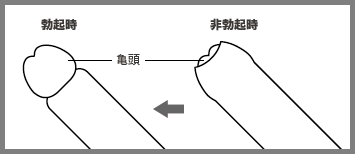 限りなく真性に近い仮性包茎の場合カリの部分がとても洗いにくいですよね？ 立っちゃってる場合は特に(´；ω；｀) | Peing -質問箱-