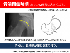 越谷市で股関節痛を根本改善【ベテラン院長が施術】新越谷・南越谷駅スグ