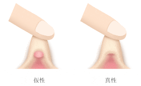 クリトリスの場所はどこ？構造・役割と快感を感じるためのいじり方 | Ray(レイ)