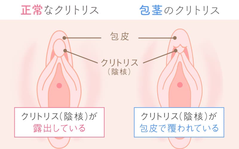 オマンコ手マンクリトリスエロ画像】オマンコやクリトリスを指で触られて、その刺激と快楽に顔を歪ませて悶える表情が何ともエロいｗｗｗ | 