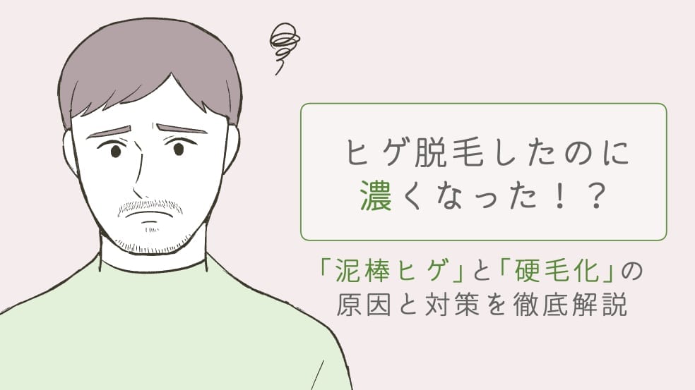 実体験】中学生からヒゲを抜き続けたら薄くなった話【30代まで】