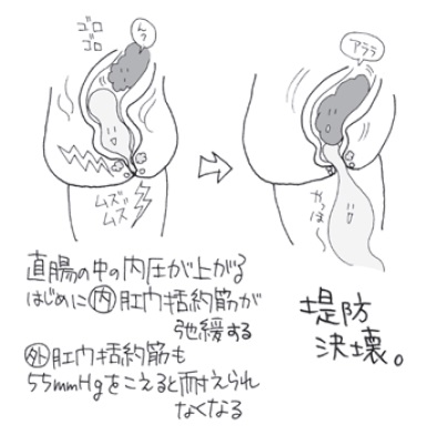 安全なグリセリン浣腸の実施について ＞