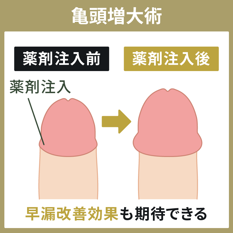 亀の増大手術から3日目。手術後〜今の様子。 | しみけんオフィシャルブログ「光り輝くクズでありたい」Powered by