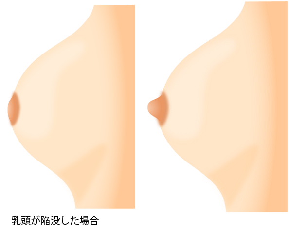 乳首の勃起】女は感じるからたつの？男が知らないちくび | 【きもイク】気持ちよくイクカラダ